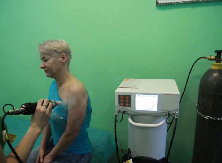 Krioterapia miejscowa